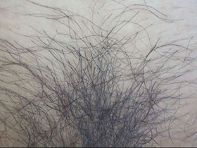 300人のまん毛3　サンプル画像05